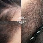 Трихопигментация — Без техники — Агнесса